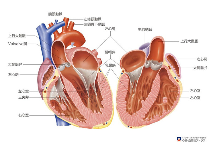 大動脈弁狭窄症のイメージ