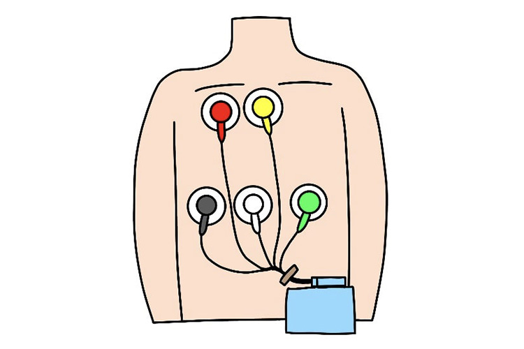 心電図のイメージ